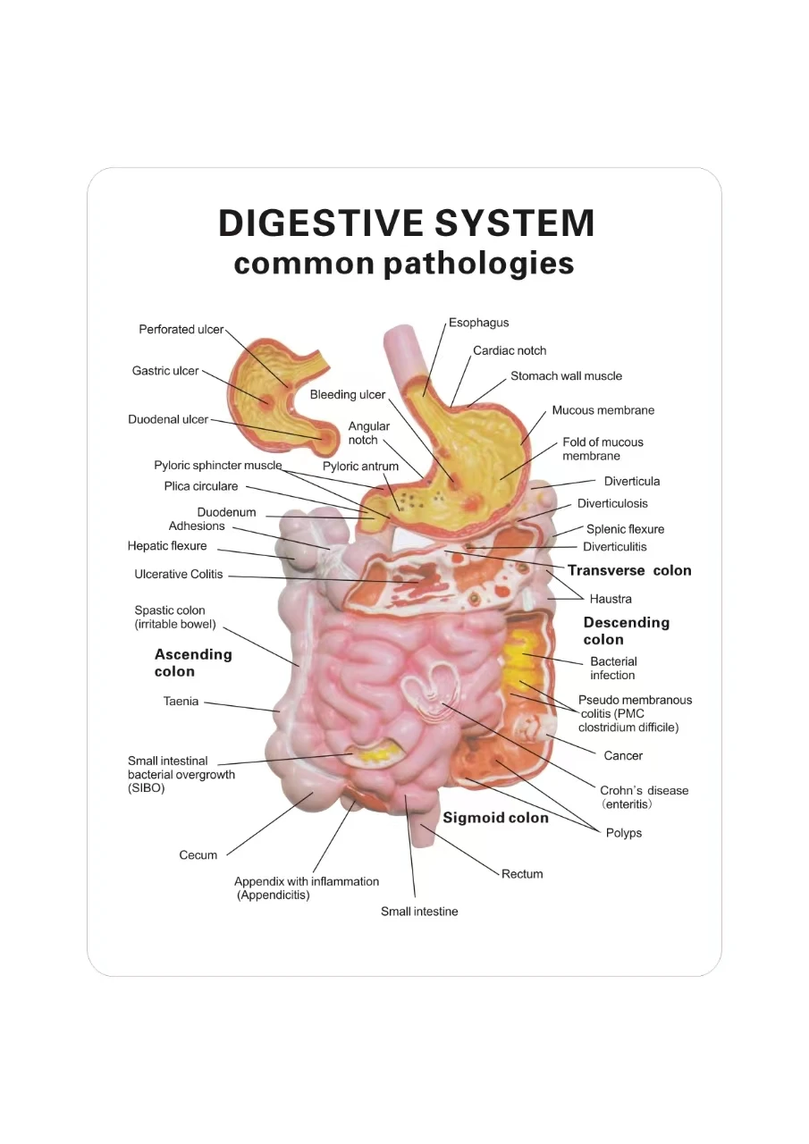 Human Digestive System Model Stomach Anatomy Large Intestine Cecum Rectum Duodenum Human Internal Organs Structure Model ﻿