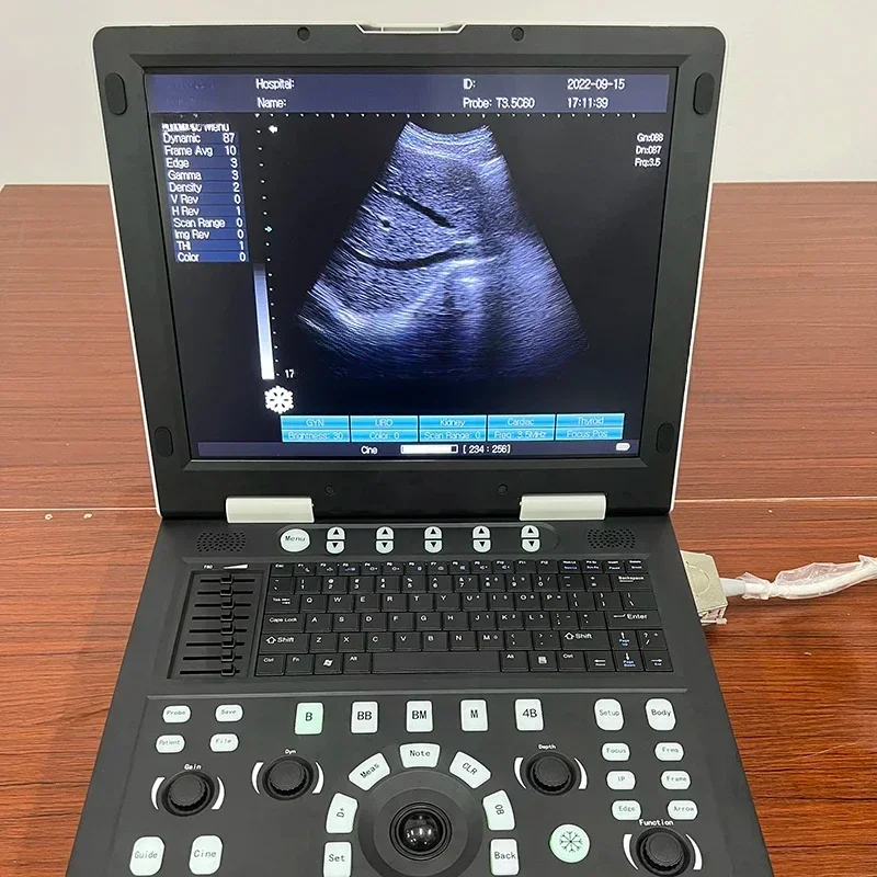

Hot sales Portable Ultrasound Machine veterinary instrument ultrasound machine for animal/cattle cow horse goat use