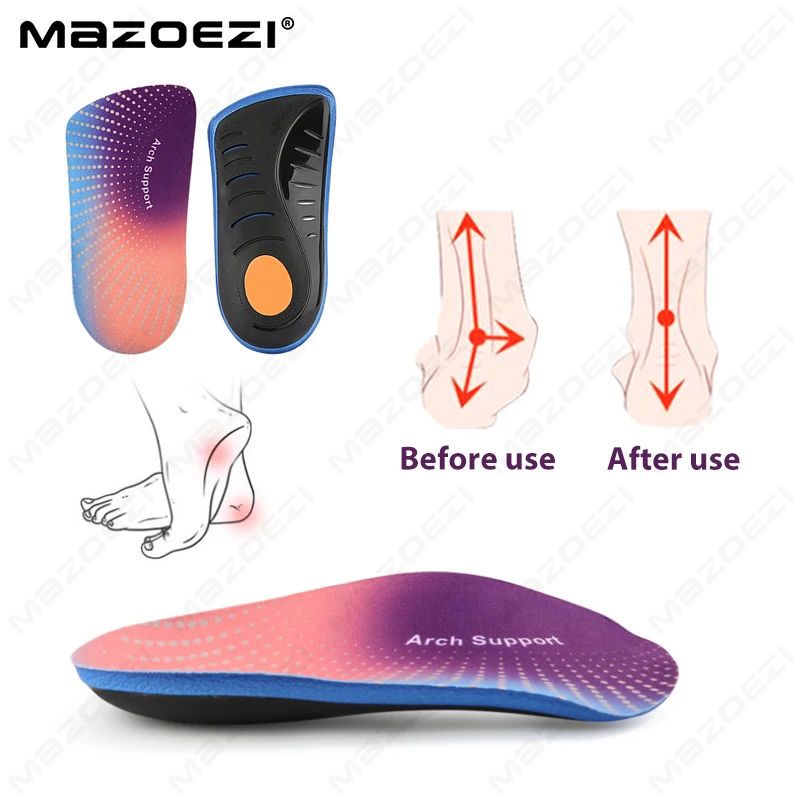 #26 Low Cost Heel Spurs That Work