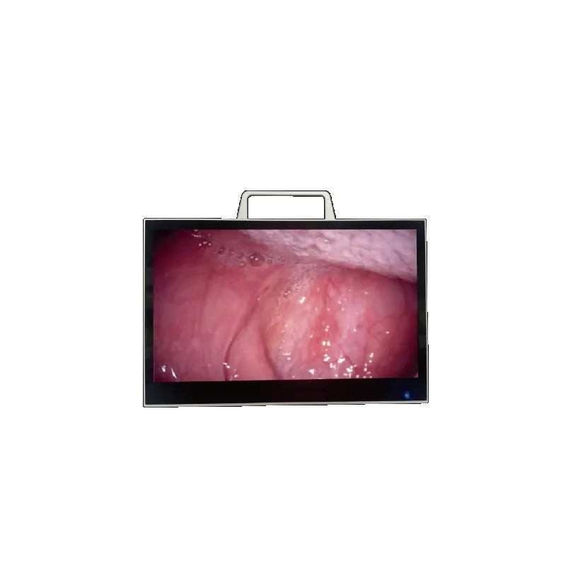 A new generation of veterinary all-in-one portable multi-function endoscope system, suitable for veterinary rigidity and flexibi
