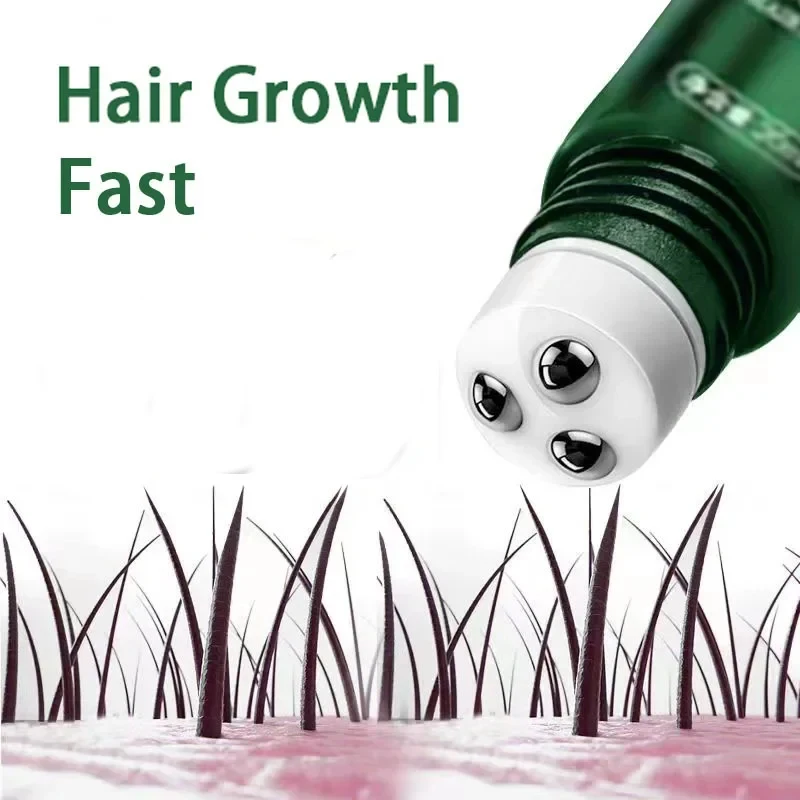 Hair Growth Oil Fast Growing Hair Effective Essential Baldness Repair Hereditary Anti Postpartum Seborrheic Hair Loss Products