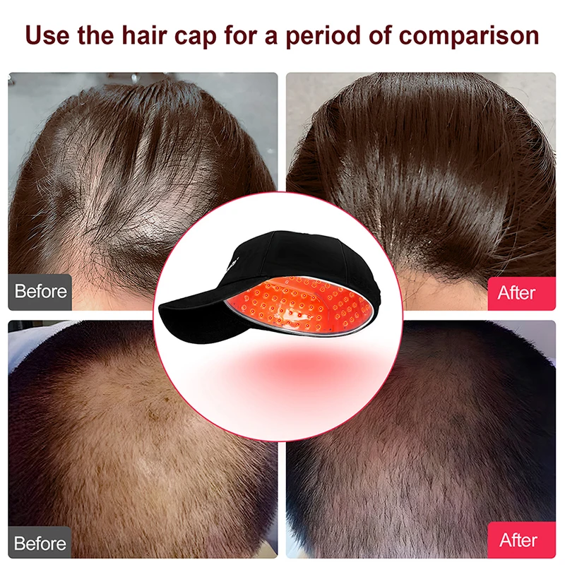 Portable Laser Hair Growth Cap Red Light Therapy LLLT Low Level Laser Therapy Devices Promote Hair Growth in Women and Men 2025