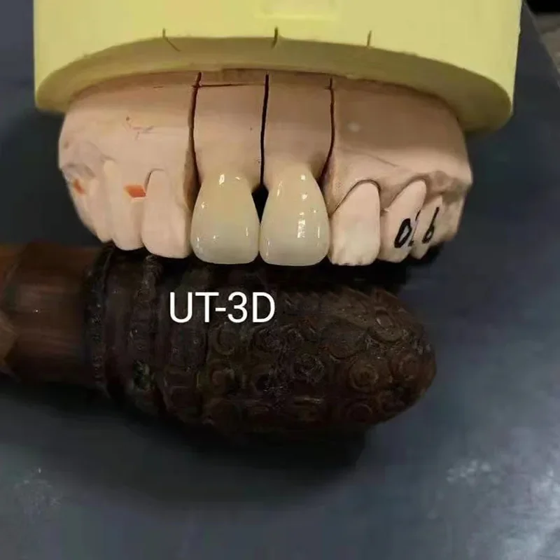 Dental Zirconia Block All-Ceramic UT3D Six Layers Disc Nature Shade Transition Multiple Bridges Dentist Materials 98mm*10-25mm