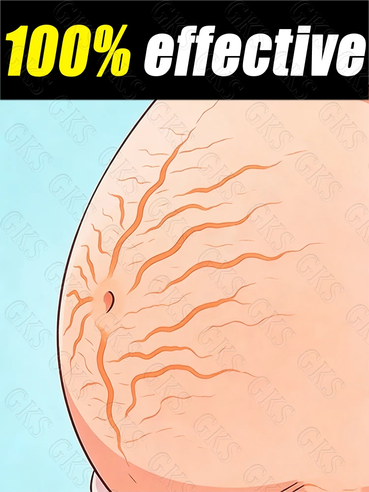 

Питательное тело S분SMC