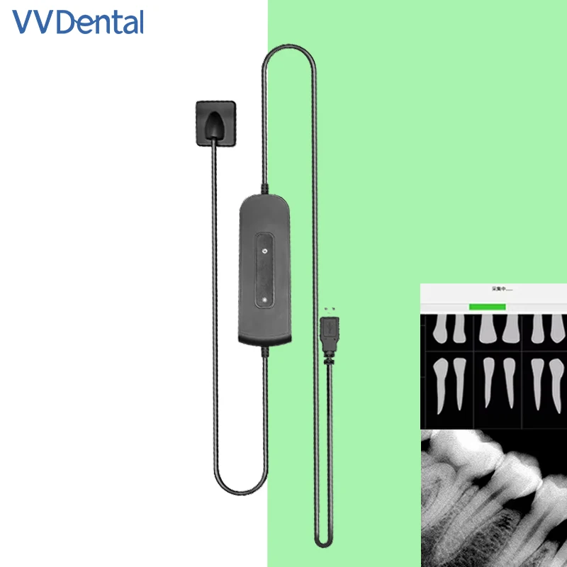 

Стоматологический цифровой датчик RVG, портативный рентгеновский датчик, радиовизиограф, высокочастотная система внутриротовой визуализации, HD-изображение, стоматологические инструменты
