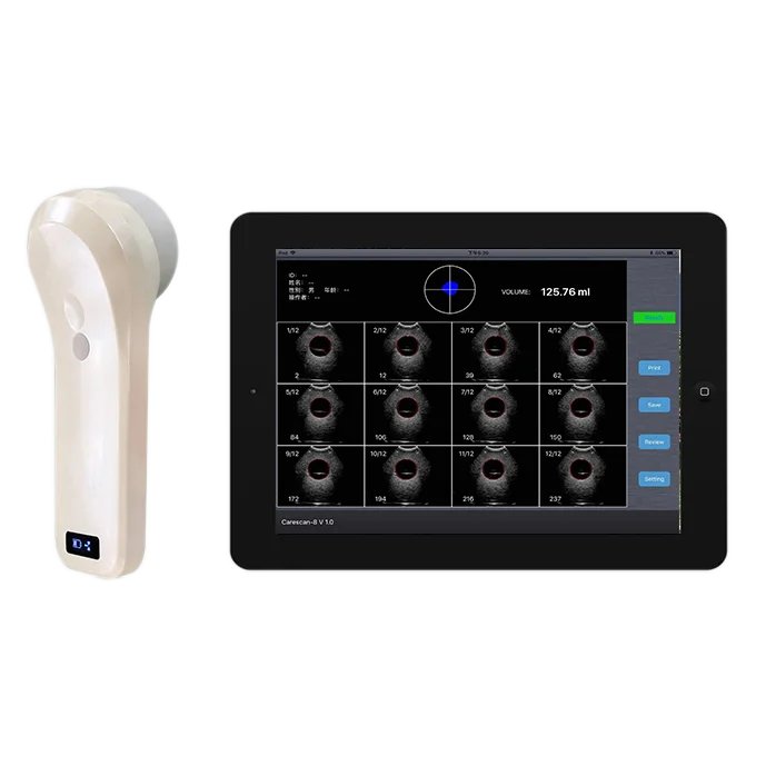 

Medical Equipment 80 Element 4D Wireless Probe Portable Ultrasound Bladder Scanner