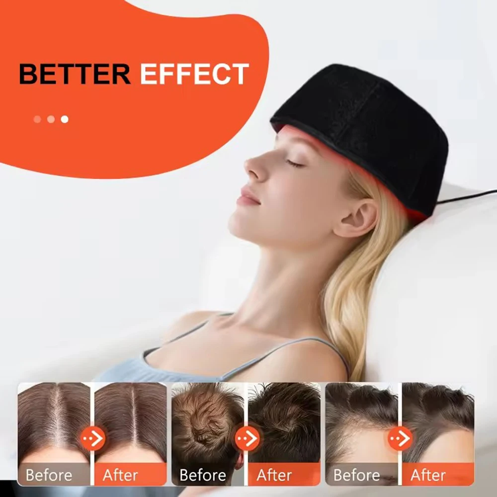 Thumbnail 2 - #70 Compare Hair Loss Treatments Before You Buy