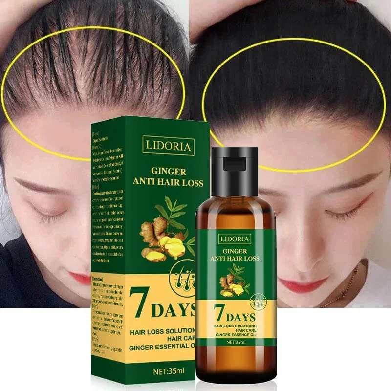 7DAYS Hair Growth Essential Oils Ginger Hair Loss Treatment Serum Products Prevent Hair Thinning Dry Frizzy Repair for Women Men