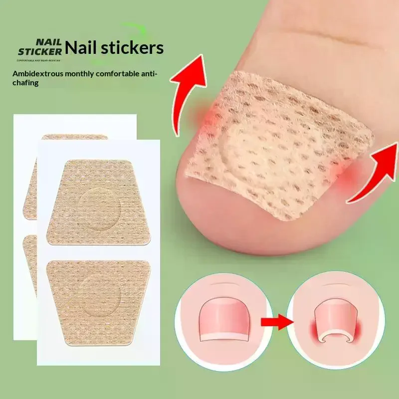 50 Sheets Gentle And Breathable Nail Ingrown Correction Sticker Miracle Tea Tree Oil Nail Patch Suitable For Toenails