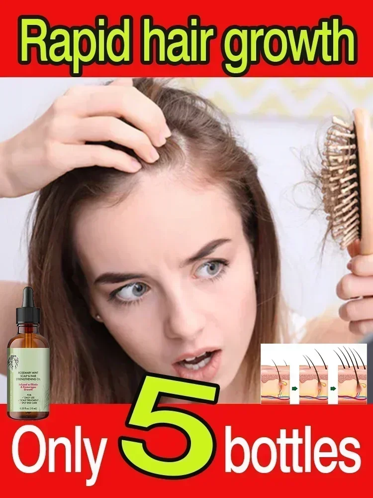 Olio essenziale per la crescita dei capelli olio rinforzante per capelli alla menta al rosmarino trattamento nutriente per doppie punte e capelli secchi Mielle Organics