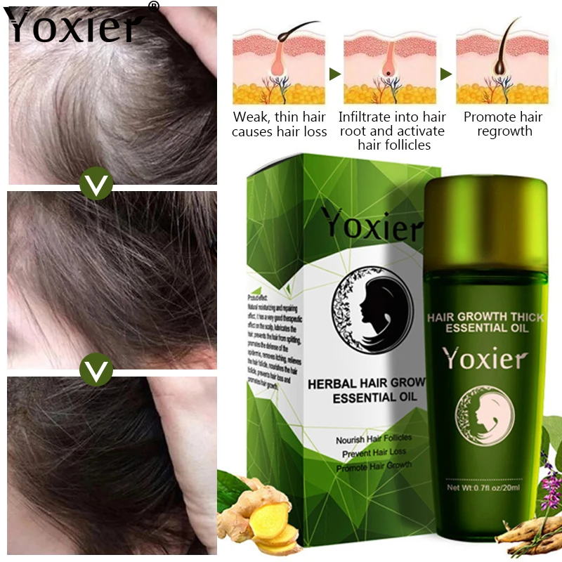 Herbal Hair Growth Essential Oil Germinal Hair Growth Serum Essence Oil Hair Loss Treatment Growth Hair For Men Women 20ml