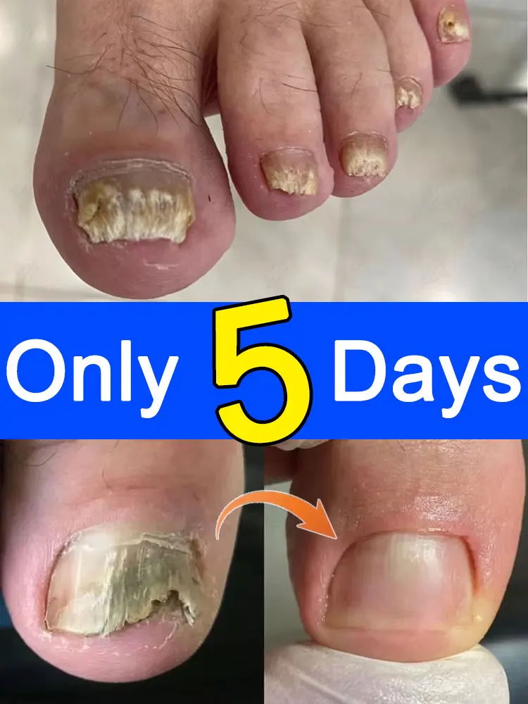 

Очень хорошие ногти