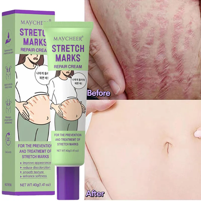 

Stretch Marks Repair Cream Fade Lines Improve Duliness Tightness Long-lasting Moisturizing Smooth Enhance Elasticity Body Care