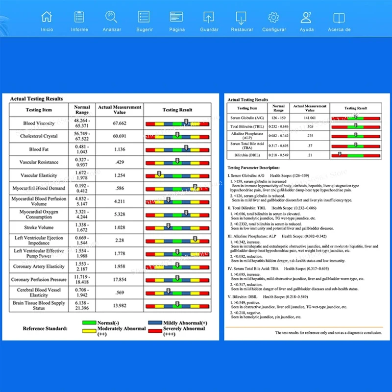 تحديث الجيل الكمي محلل الرنين المغناطيسي 2023 المهنية النسخة الجديدة الجسم الماسح الضوئي آلة تشخيص الصحة الفرعية