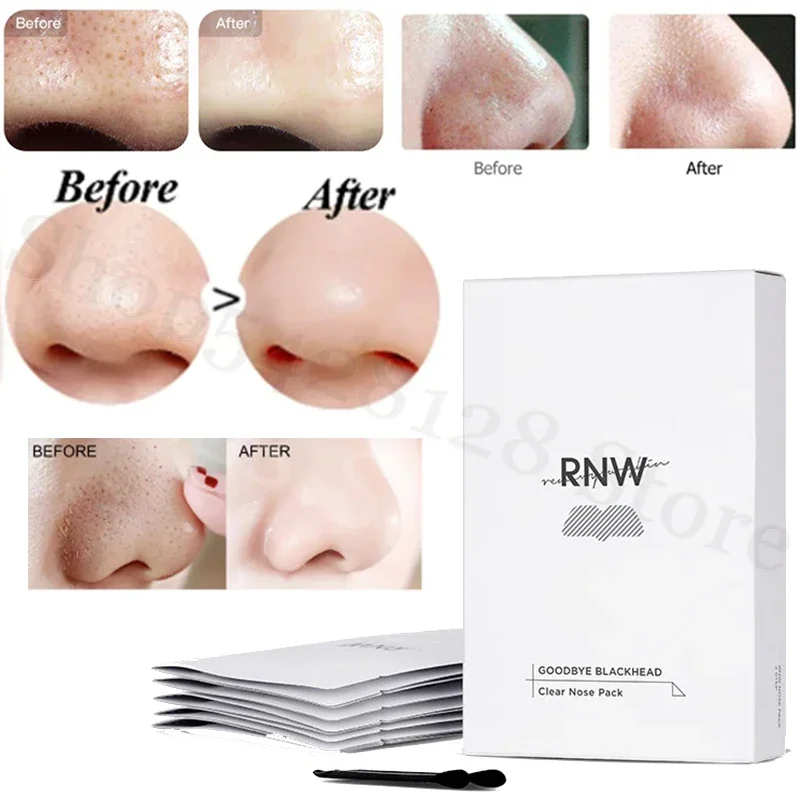 RNW nasal stickers to remove blackheads and shrink pores, deep cleansing T-zone care, warm and non-irritating nasal stickers