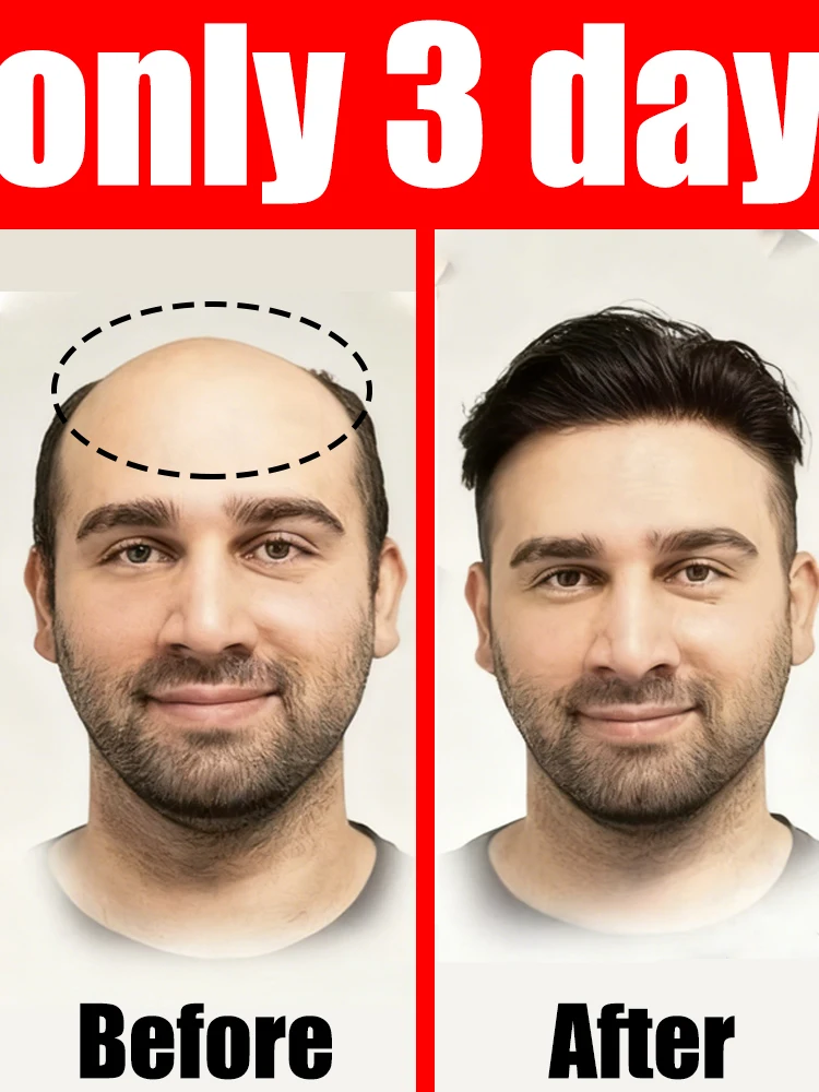 

Lᴀᴛᴇsᴛ ᴅɪsᴄᴏᴜɴᴛs priority shipping, buy early and ᵉⁿʲᵒʸ!