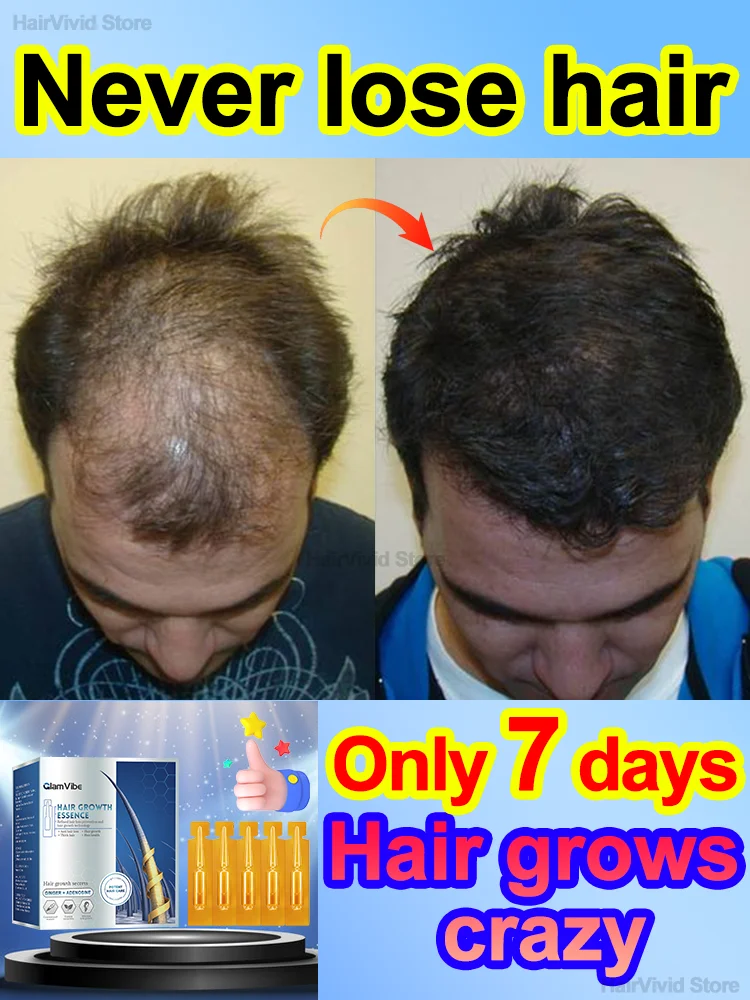 

Highly effective hair growth, limited time promotion, buy 3 get 2 free, buy 5 get 5 free, buy 10 get 22 free，anti hair loss