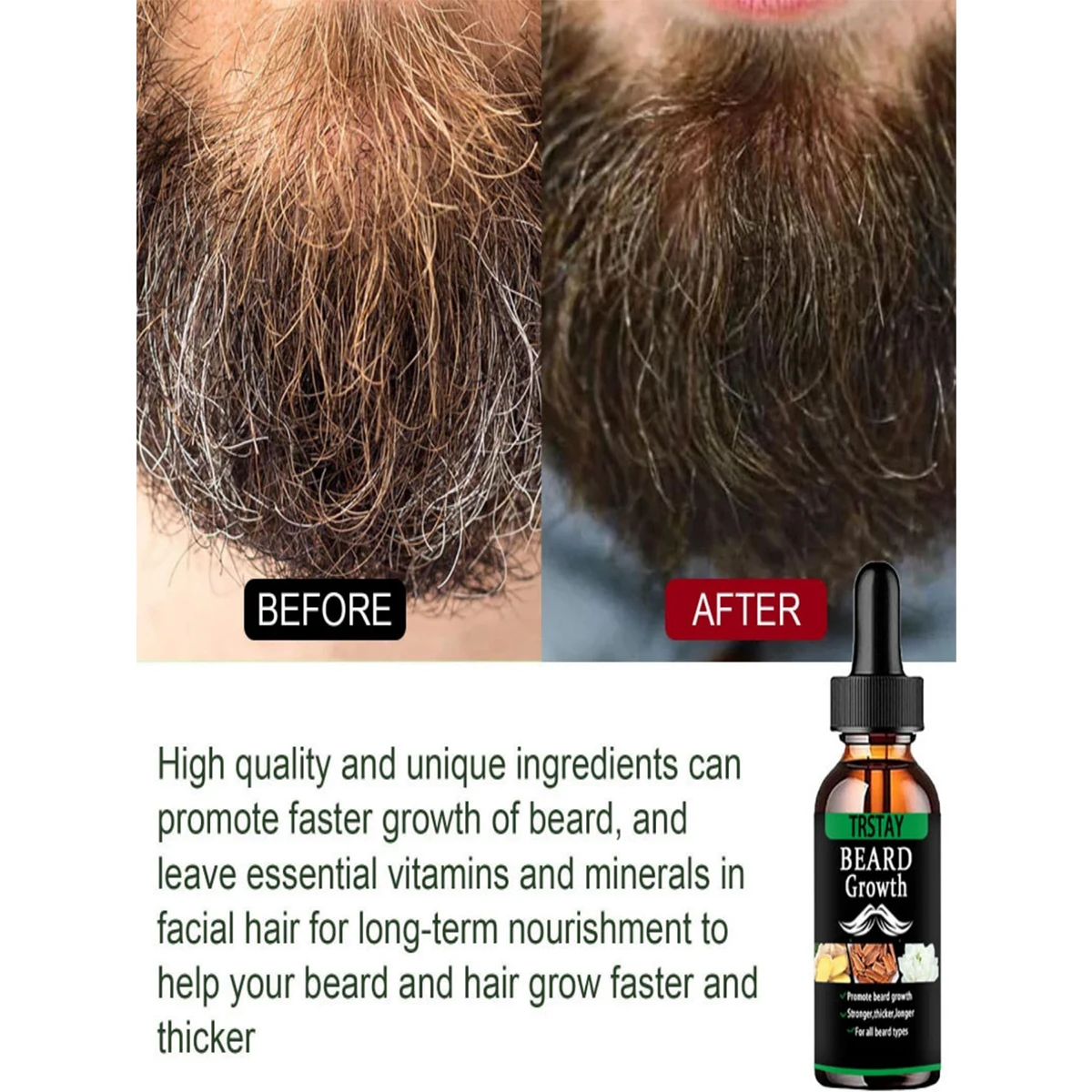 Men Beard Growth Essential Oils Essence Spray Nourishing and Moisturizing Spray Beard Care Grooming Oil