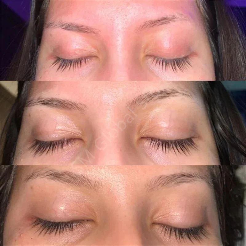 Snelle Wimpergroei Serum Producten Wimpers Wenkbrauwen Verbeteren Voller Dikkere Wimpers Behandeling Verlenging Lash Lift Oogzorg