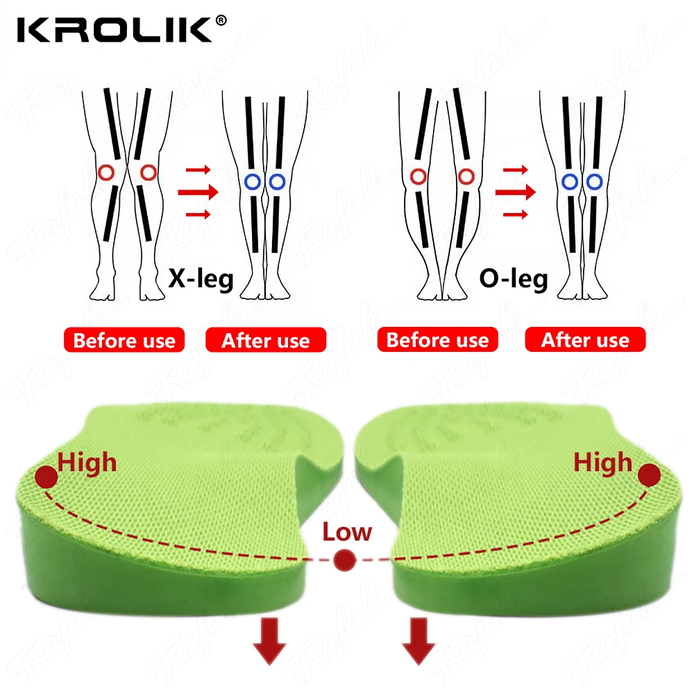 O/X-Leg Orthopedic Insoles Arch Support Insole Corrigibil Bow Legs Valgus Varus Massaging Shoe Pads Beauty Leg Feet Care