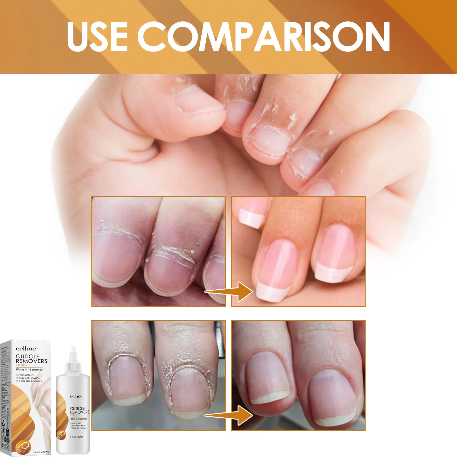 Instant Cuticle Care Gel Repair Gray Nail Soft Nail Rotten Nail Dead Skin Moisturizing Care Solution