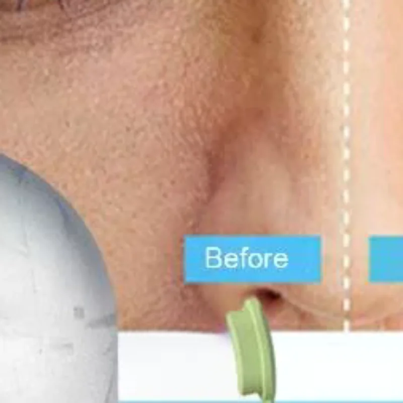Face Ice Roller Puffiness - Ice Face Roller Ice Cube Beauty