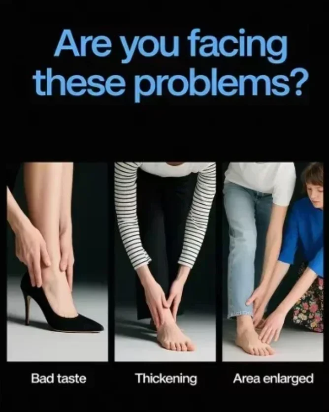 네일 수리 레이저 장비, 블루 라이트, 네일 케어 도구.