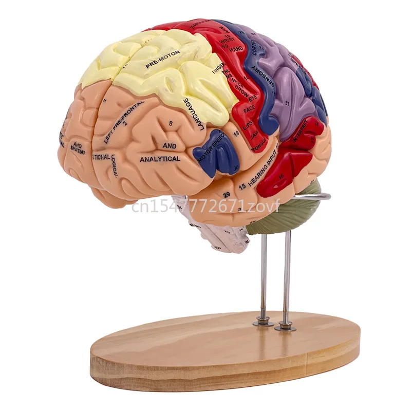 2 Times Magnification 4 Parts Brain Attached Cerebral Artery Model Cerebrovascular Model Neurology Human Brain Anatomy Model