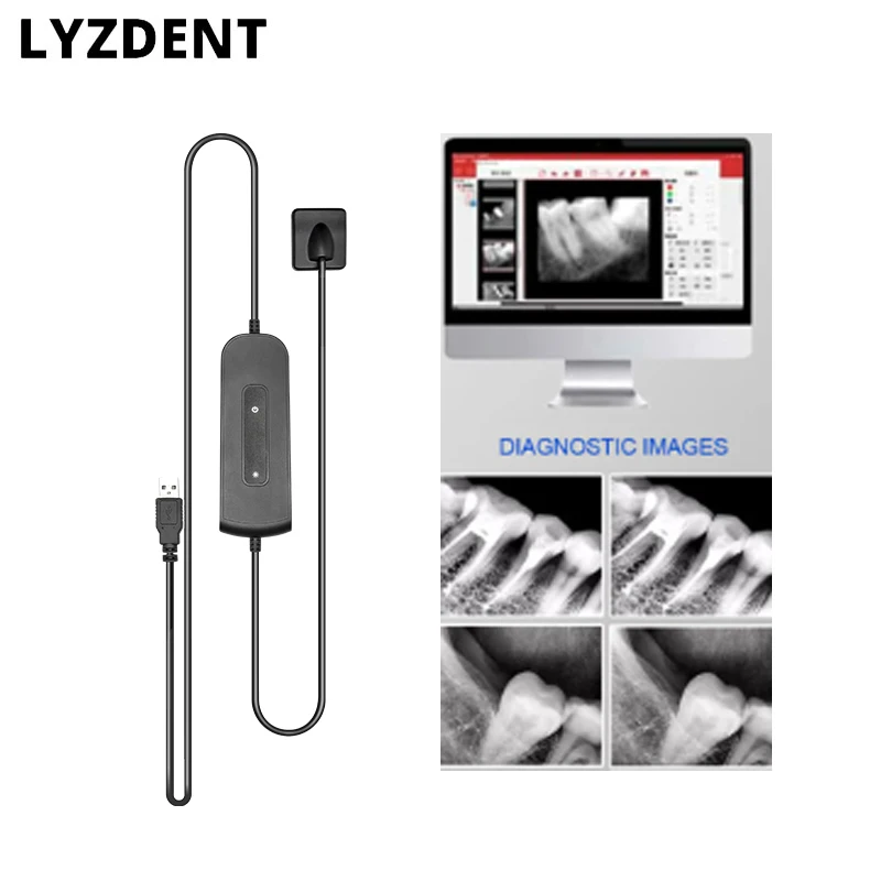 

Dental Dentistry Digital cameras Sensor X-Ray High-Frequency Rx Digital Intraoral Digital System H D Image Radiovisografo Tools