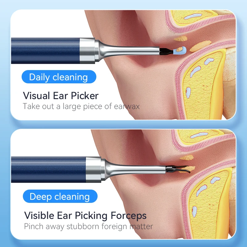 WIFI Wax Endoscope 8MP HD Earpick Smart Visual Ear Cleaner with Tweezers Powered Mini Camera Otoscope Personal Health Care Tool