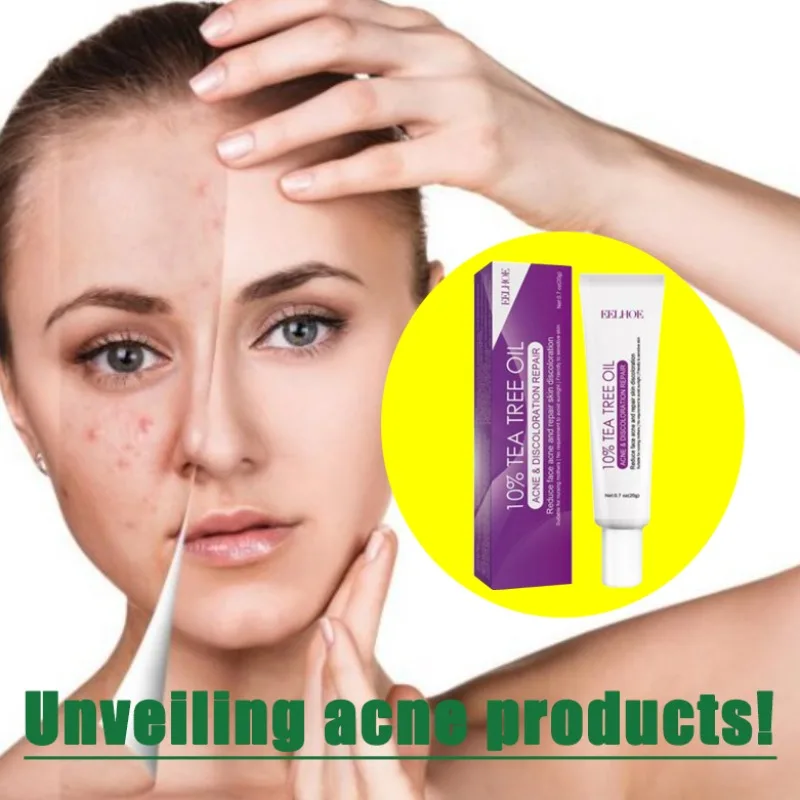 

Acne Removing&Acne Removing face cream Anti acne Cream Treatment Acne Repairing Skin Care Whitening&Acne Removing face cream