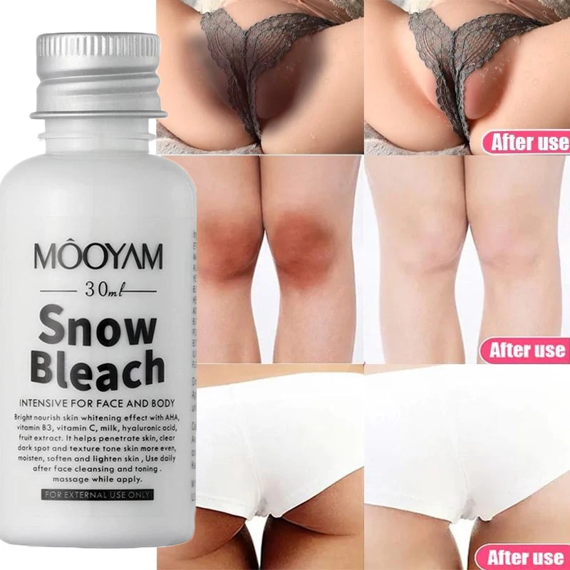 

Body Whitening Cream Private Parts Underarm Bleaching Cream Whiten Butt Knee Improve Dull Remove Melanin Brighten Skin Care