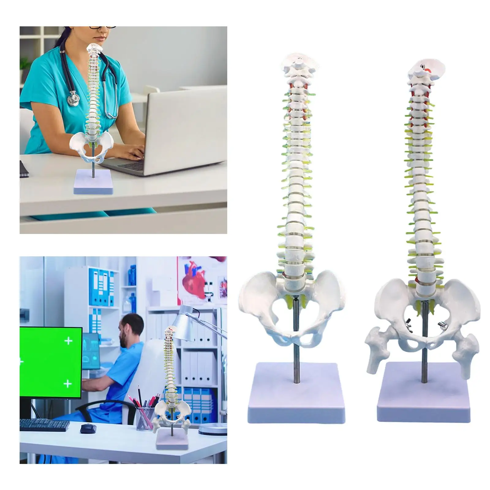 Human Spine Model Skeleton 17.7inch for Teaching Aid Learning Education Tool