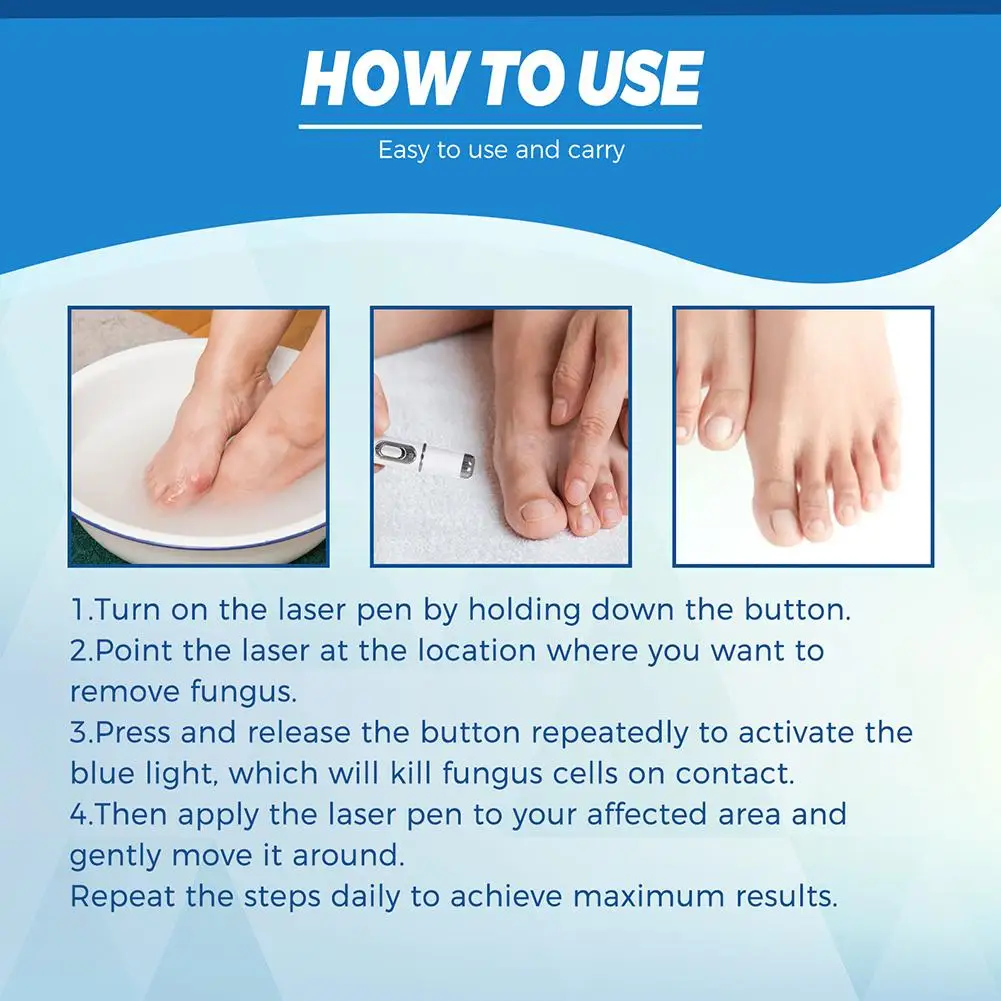 1Pcs Nail Fungus Treatment Pen Anti-fungal Repair Pen Blue Light Laser Pen Paronychia Onychomycosis Painless Nail Repair Kit