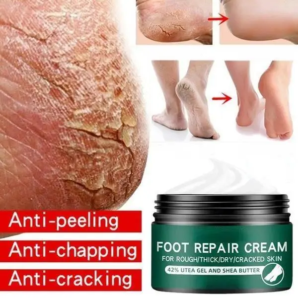 Newest Hand and Foot Skin Repairing Moisturizer Cream Anti-Chapping for Rough Dry and Cracked Chapped Feet Heel Repair Foot