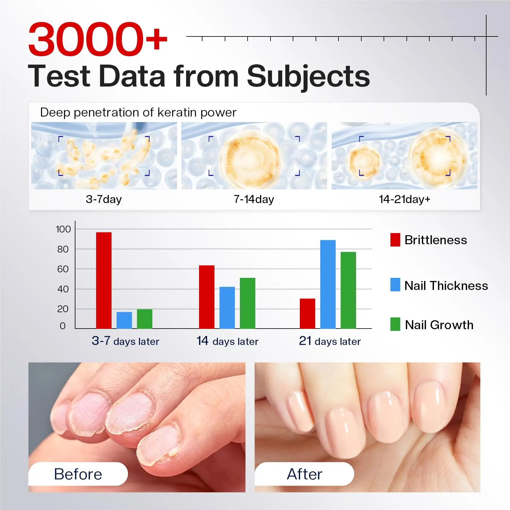 مقوي الأظافر والنمو: مقوي طلاء الأظافر لعلاج الأظافر التالفة، إصلاح طبيعي يمنع تكسير اللون