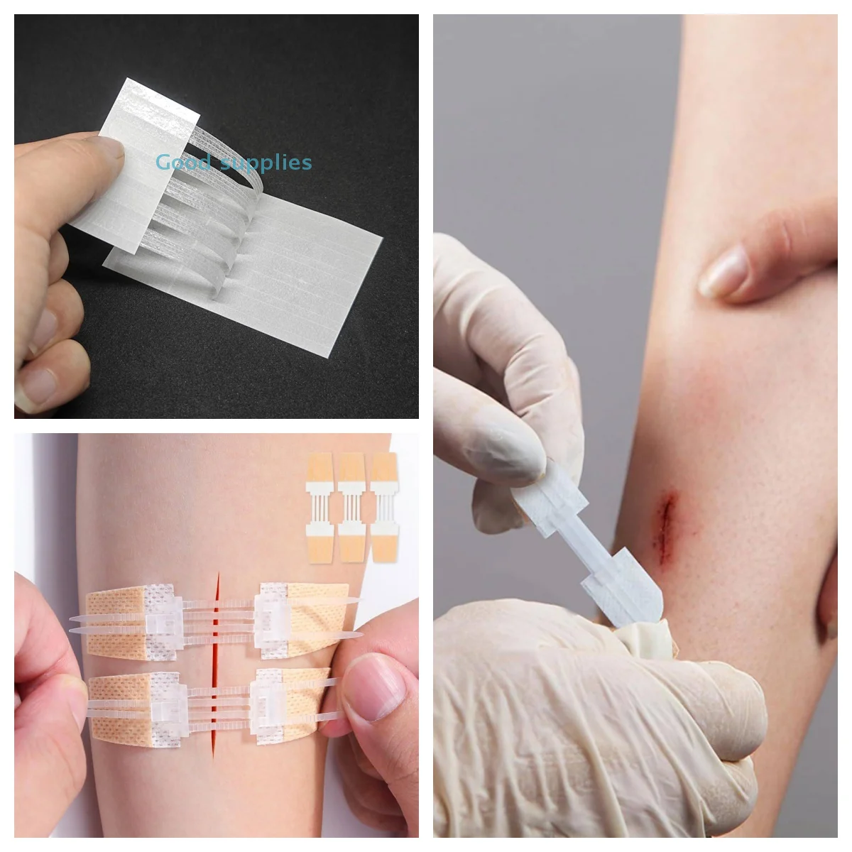 

Пластырь на молнии, безболезненный пластырь для закрытия ран, без швов, пластыри для перевязки на рану, редуктор швов на молнии, пластырь для улицы, портативный