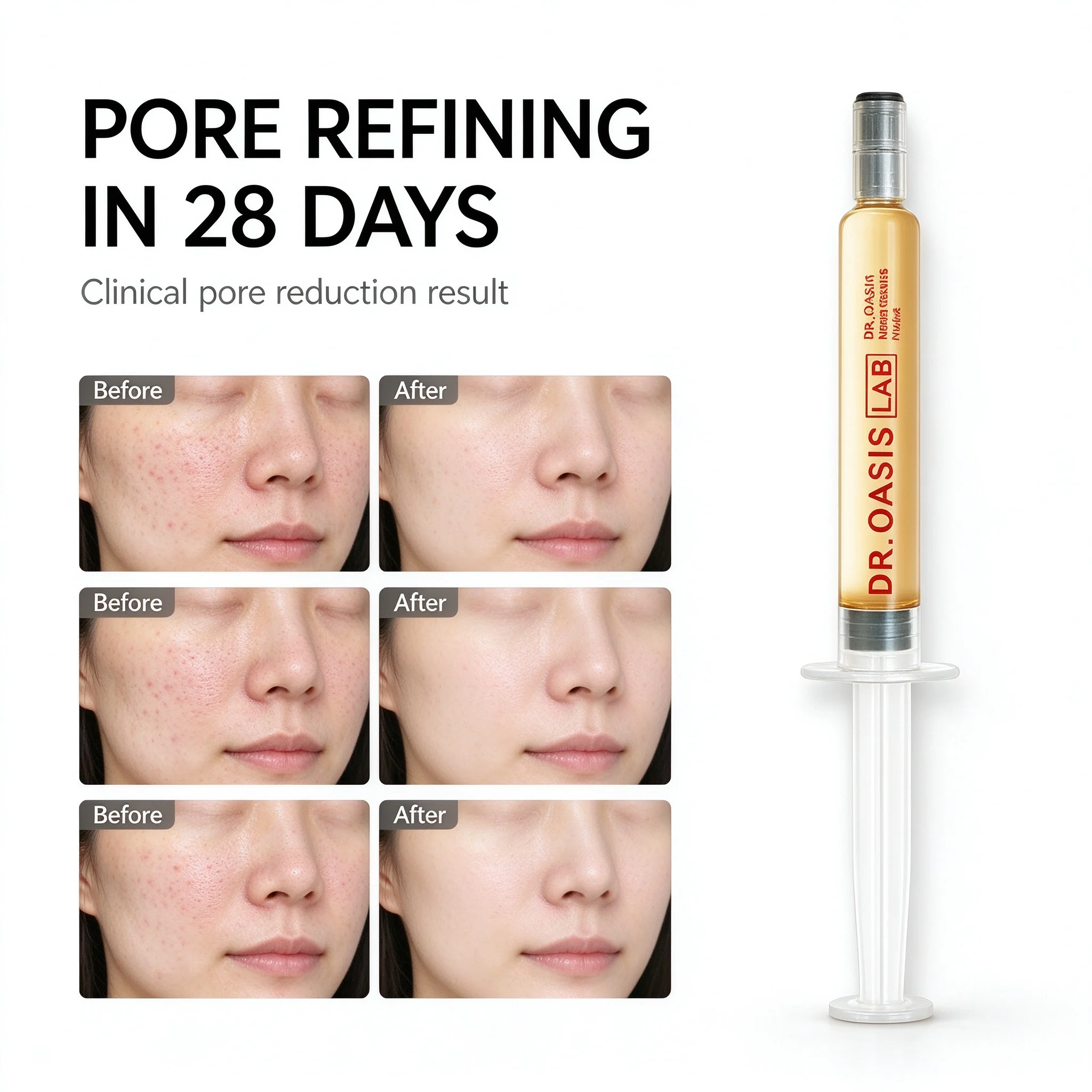 EC Spicule 15um Micro Needle Serum 1000PPM Spicules 7 Peptides Collagen Elastin Ceramide Anti Aging Ampoule for Fine Lines
