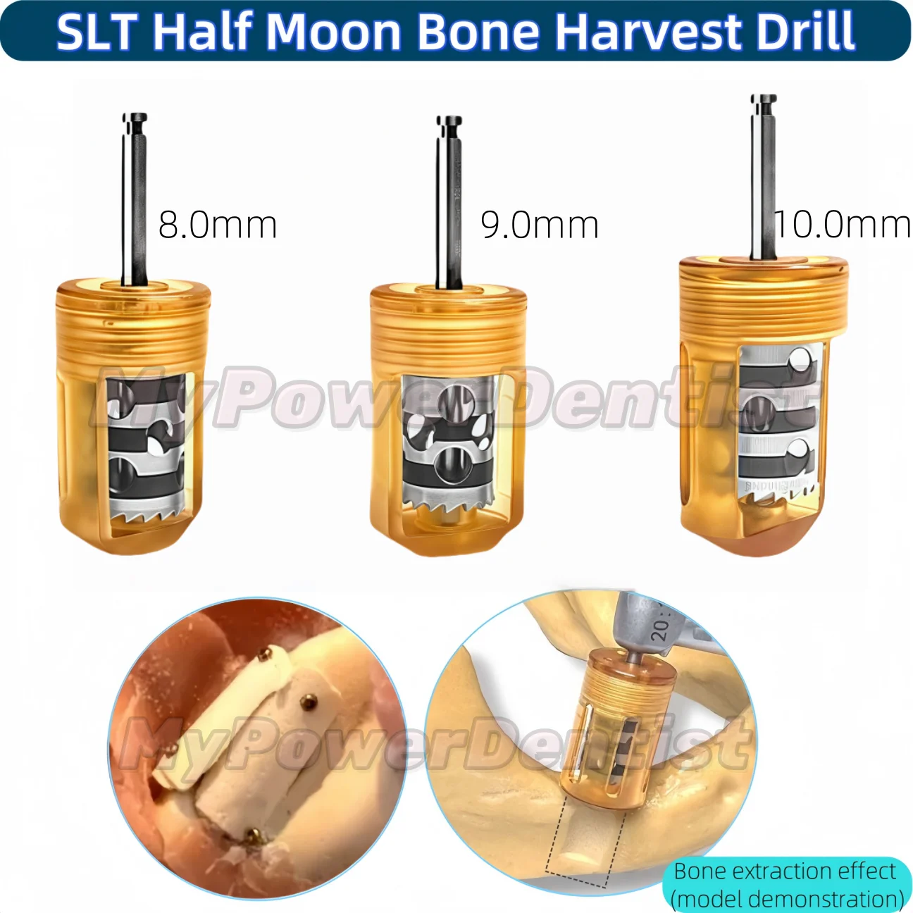 

3Size Dental SLT Half Moon Bone Harvest Drill Semilunar Technique Collector Drills 8.0/9.0/10.0mm