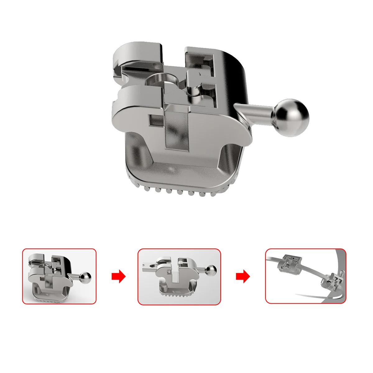 24 Stück/Box AZDENT Dental Kieferorthopädische Klammern Passive selbstligierende Zahnspangen mit Werkzeug Roth.022 Haken 345 & 1st Molar Bukkalröhrchen – Detail 8