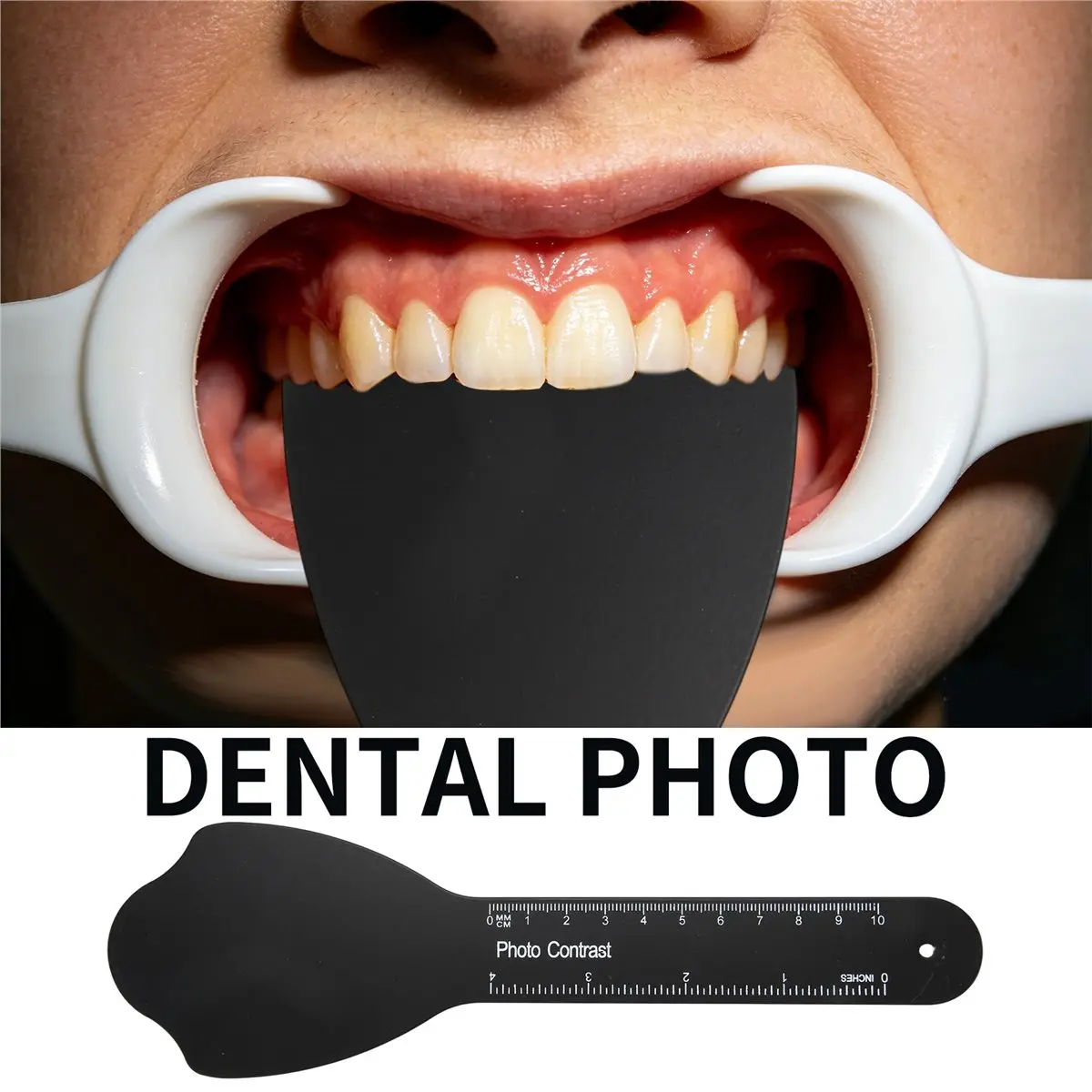 [N88R] Dental Contraster Intraoral Photographic, 6 PCS Dental Photo Contrast Kit Palatal Intraoral Photography Kit