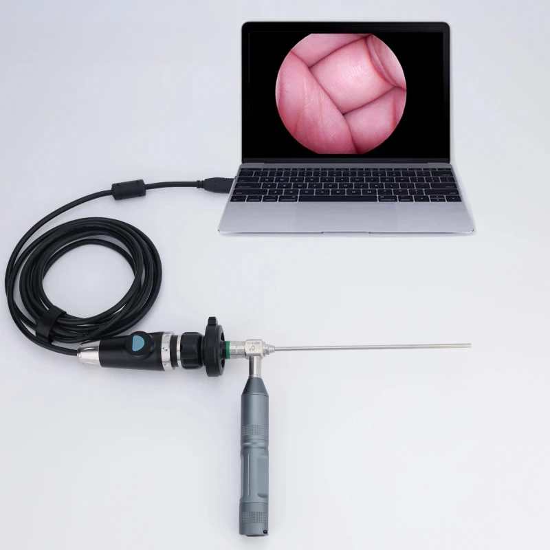 

Medical USB Endoscope Full HD 1080P For ENT/Oral/Pet Inspection Or Surgery