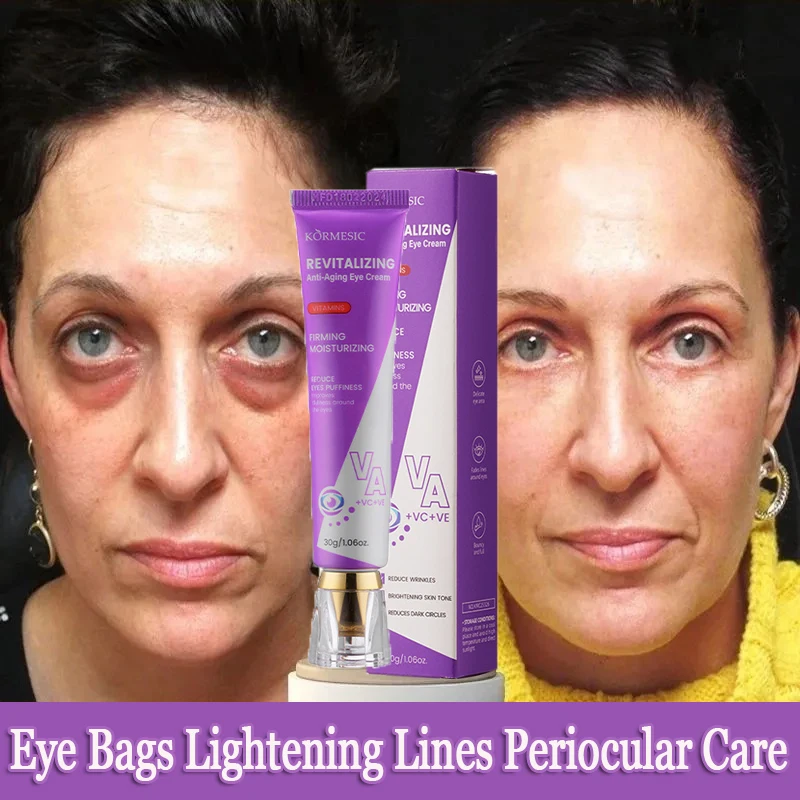 

Eye Cream Moisturizing Firming Removing Eye Bags Lightening Lines And Smoothing Dark Circles Anti-aging Puffiness Eye Care 30g