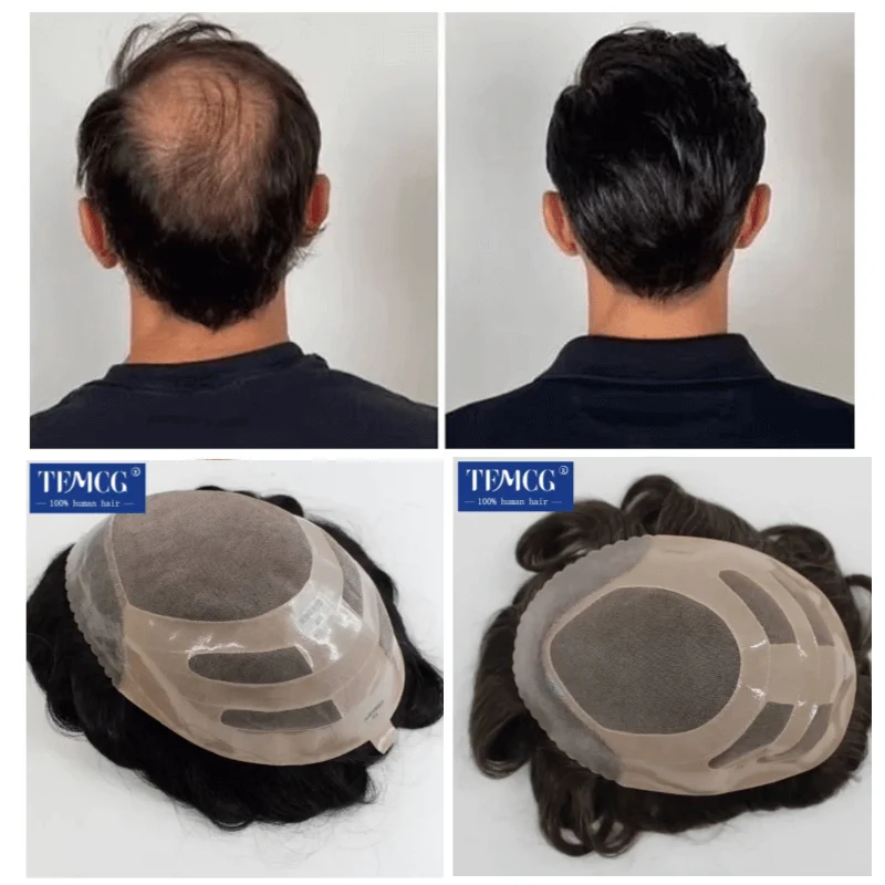 

Men's Capillary Prothesis Mono Top With PU Front & NPU Back Male Hair Prosthesis Replacement System Unit 100% Human Hair Men Wig