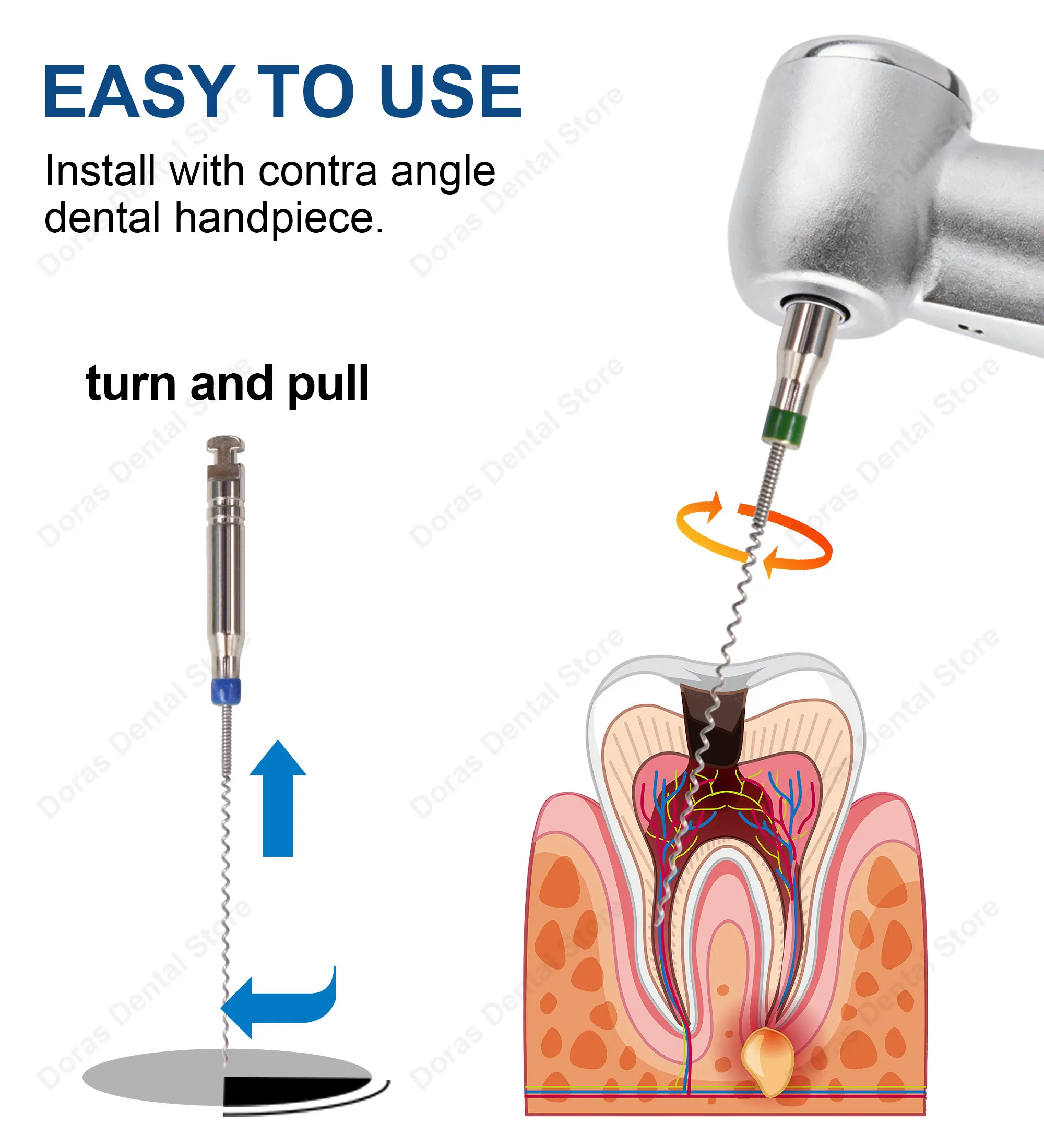 1 Box Dental Dentistry Lentulo Paste Carriers Endodontic Endo Files Reamers Drill Burs Endo Files Dentist Materials