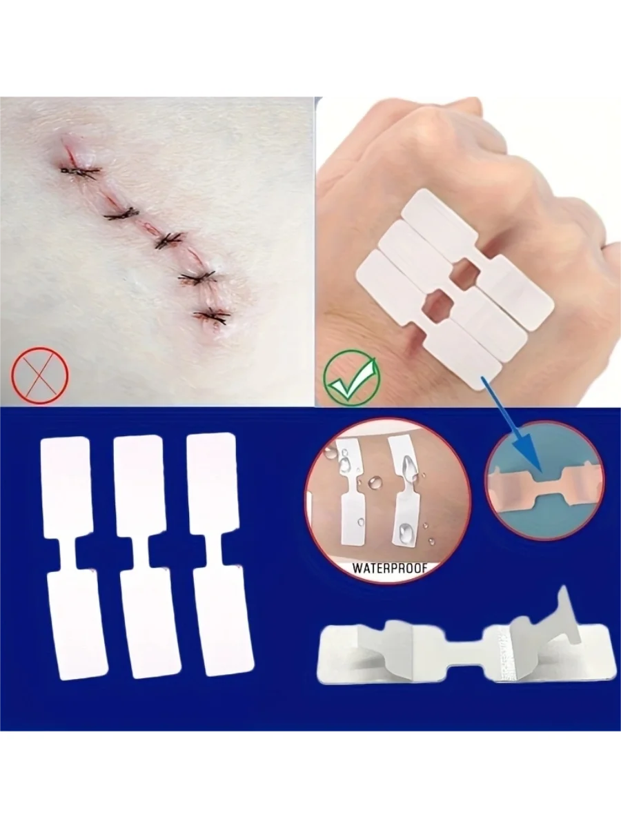 5Pcs Outdoor Wound Adhesive Tape Disposable First Aid Wound Suture Patch Wound Band Aid