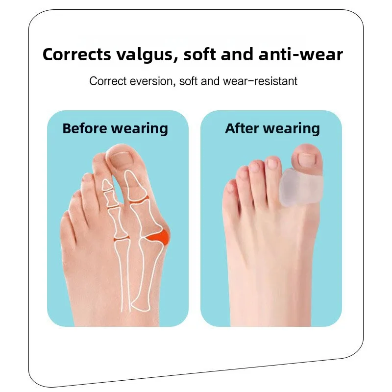 1 Pair Clear Silicone Toe Separators Bunion Correction Cushion Orthopedic Foot Pads Pain Relief Foot Care