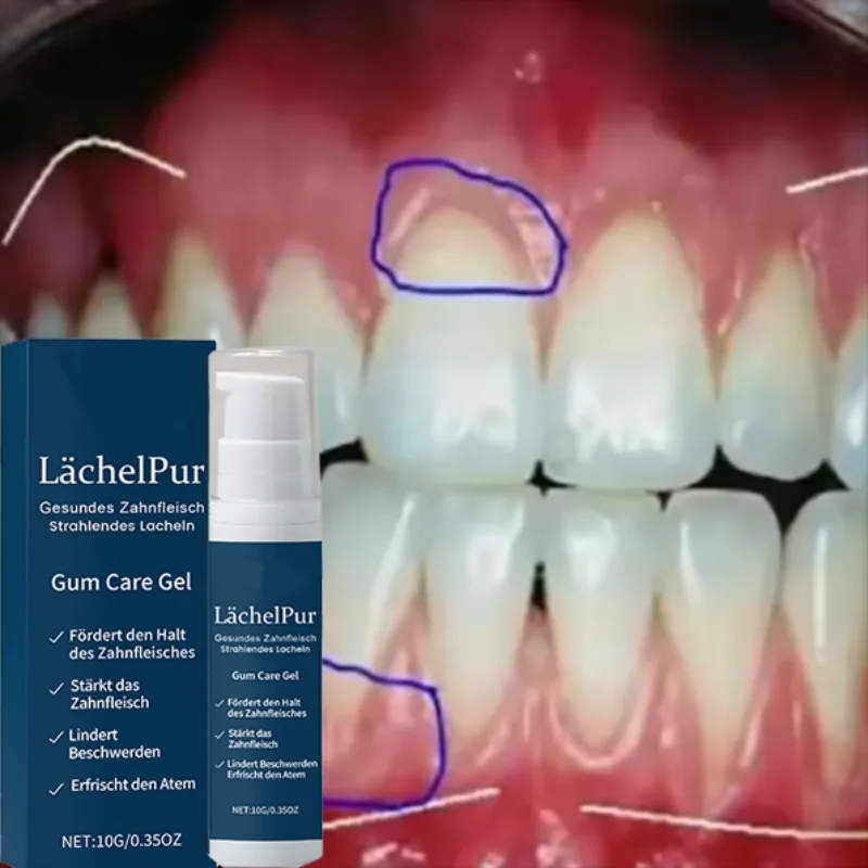 

Es aziazi7 .Rapid Repair Gums