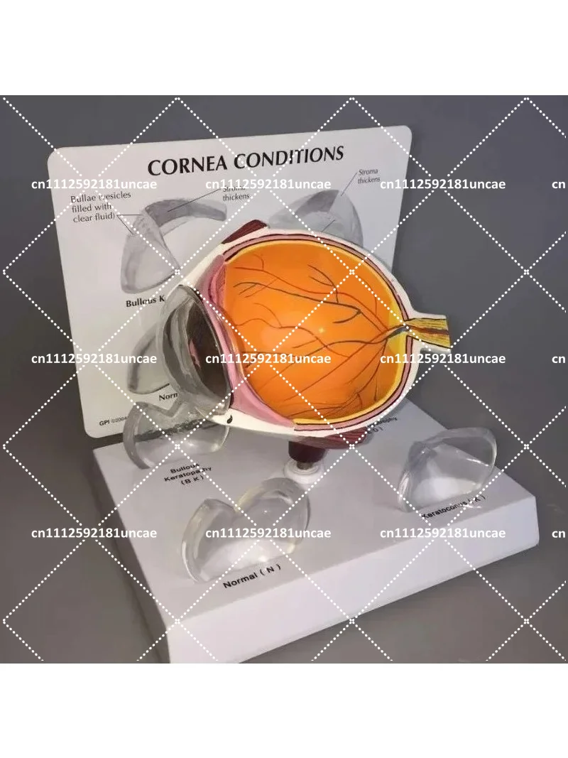 Human Eye Anatomy Model for Science Education Biology Teaching Tool 12x10x8cm