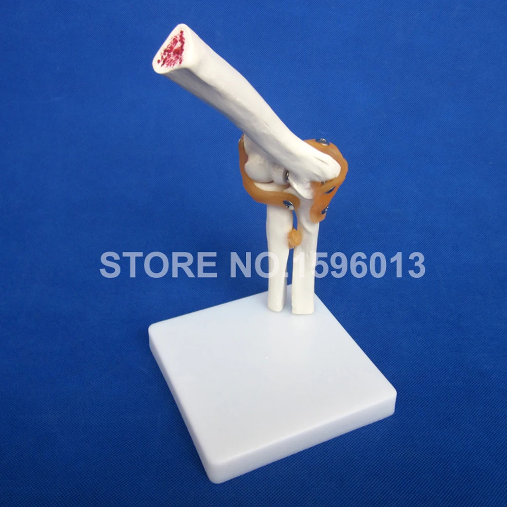 HOT Life-Size Elbow Joint Model, Bone with Ligament Anatomical Teaching Demonstration Simulator